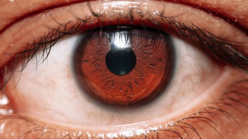 Zapalenie oka – czym się charakteryzuje i jak je leczyć?