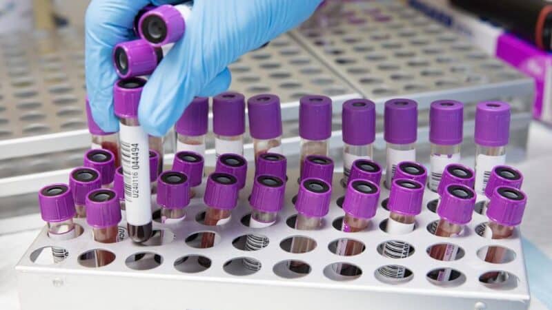 Biomarkery w diagnostyce chorób mózgu – klucz do wczesnego wykrywania schorzeń neurologicznych